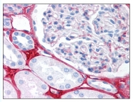 AP07843PU-N - Collagen type III alpha 1 chain