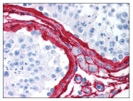 AP07843PU-N - Collagen type III alpha 1 chain