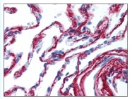 AP07844PU-N - Collagen type VI