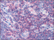 AP07139PU-N - CD3