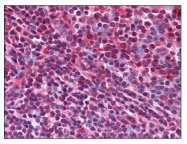 AP07856PU-N - CD5L / API6