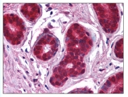 AP07862SU-N - NFKBIA / IKBA