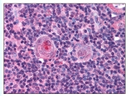 AP07863SU-N - NFYB