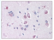 AP07865PU-N - Delta-like protein 1