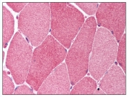 AP07873PU-N - Bcl-10