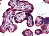 AP07154PU-N - Cytokeratin 19