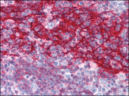 AP07157PU-N - CD23