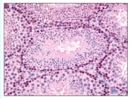 AP07877PU-N - GLI2