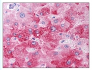 AP07888PU-N - BMP1