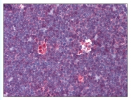 AP07897PU-N - Adenosine deaminase