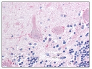 AP07901PU-N - MLLT2 / AF4