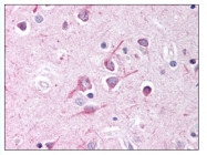 AP07901PU-N - MLLT2 / AF4