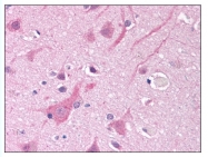 AP07905PU-N - SCN5A