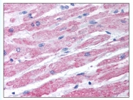 AP07909PU-N - Dysferlin