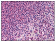AP07922PU-N - CD278 / ICOS