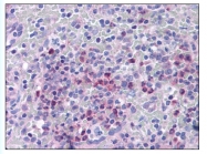 AP07923PU-N - ITGB1BP1 / ICAP1