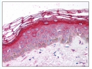 AP07928PU-N - CD140a / PDGFRA