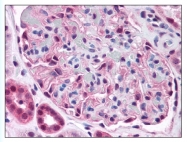 AP07930PU-N - PDPK1