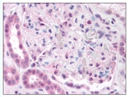 AP07931PU-N - PRKACB