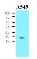 AM03185PU-N - PPP1R14A
