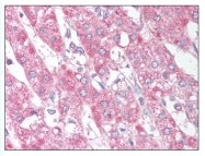 AP07972PU-N - SIRT6