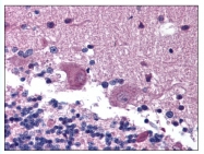 AP07994PU-N - Anosmin-1