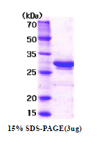 AR03040PU-L - C1QBP