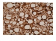 AM05374PU-N - CYP26A1