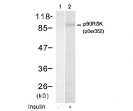 AP08006PU-N - RPS6KA1