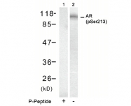 AP08008PU-N - Androgen receptor