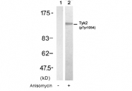AP08010PU-N - TYK2