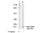 AP08013PU-N - Alpha-Synuclein / SNCA