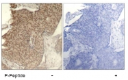 AP08014PU-N - HDAC2