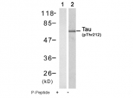 AP08019PU-N - MAPT / TAU