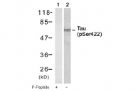 AP08020PU-S - MAPT / TAU