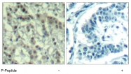 AP08036PU-S - Aurora kinase A