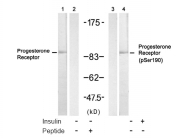 AP08044PU-S - Progesterone receptor