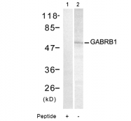 AP08059PU-N - GABRB1