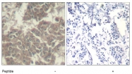 AP08094PU-N - Tyrosine-protein kinase JAK2