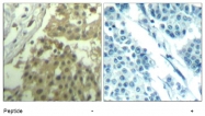 AP08098PU-N - CDK1