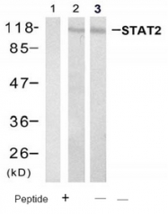 AP08100PU-N - STAT2