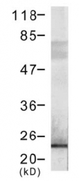 AP08111PU-N - DYKDDDDK Epitope Tag