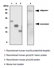 SM6027 - Adiponectin