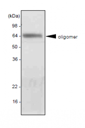 SM6014 - Adiponectin