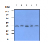 AM09005PU-N - C-reactive protein (CRP)