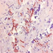 AM05894PU-N - Aspergillus