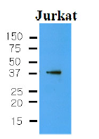 AM09007PU-N - CYR61