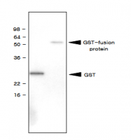 SM6024 - GST-Tag