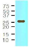 AM09020PU-N - Interleukin-33 (IL33)