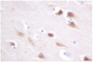 AP06515PU-N - Casein kinase II beta